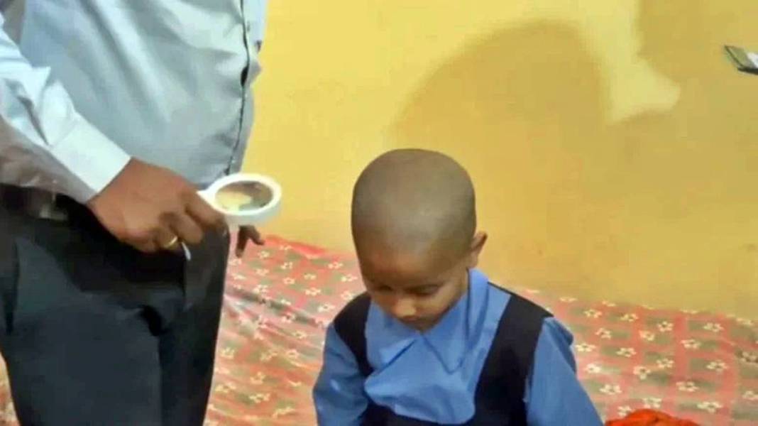 11 köyde yüzlerce kişi sabah kel olarak uyandı! Saç döken gizemli salgının nedeni o olabilir 5